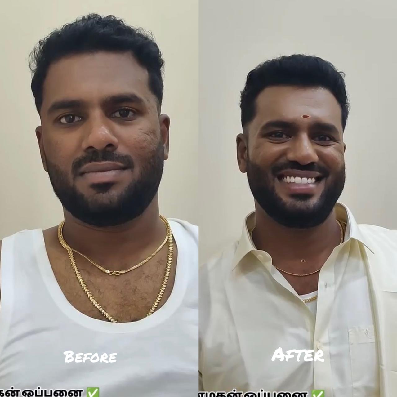 Groom Makeup Before After Chennai